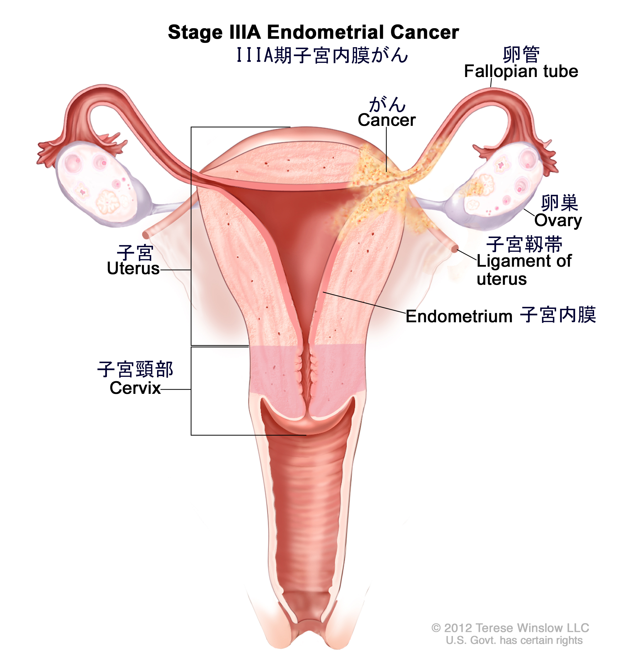 出典:cancerinfo.tri-kobe.org